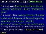 Two LECTURE on SCOLIOSIS in REGENSBURG / 10-14.05.2007
