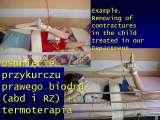 MIN.ZDROWIA/MINISTRY of HEALTH/LECTURE on 19 JUNE 2007/DOCUMENTS