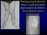 Wody geotermalne w ortopedii. Geothermal water in orthopaedic therapy.