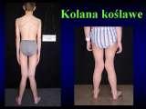 Wody geotermalne w ortopedii. Geothermal water in orthopaedic therapy.