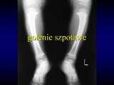 Wody geotermalne w ortopedii. Geothermal water in orthopaedic therapy.