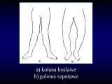 Geotermia&Ortopedia. Geothermal water in orthopaedic therapy/LECTURES