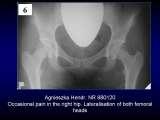 Wody geotermalne w ortopedii. Geothermal water in orthopaedic therapy.