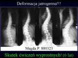 Wody geotermalne w ortopedii. Geothermal water in orthopaedic therapy.
