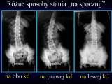 Wody geotermalne w ortopedii. Geothermal water in orthopaedic therapy.