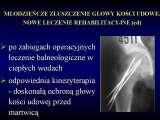 Wody geotermalne w ortopedii. Geothermal water in orthopaedic therapy.