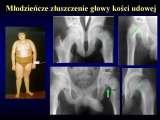 Wody geotermalne w ortopedii. Geothermal water in orthopaedic therapy.