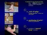 RECENT fundamental KNOWLEDGE on SCOLIOSIS/Orthop.Congress/Cairo/Egypt/LECTURE