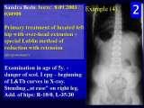 RECENT fundamental KNOWLEDGE on SCOLIOSIS/Orthop.Congress/Cairo/Egypt/LECTURE