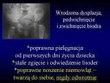 Wody geotermalne w ortopedii. Geothermal water in orthopaedic therapy.