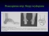 Wody geotermalne w ortopedii. Geothermal water in orthopaedic therapy. The picture taken from the book of - Prof. Gunter Wellmitz - 
