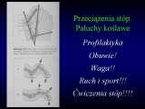 Wody geotermalne w ortopedii. Geothermal water in orthopaedic therapy. The picture taken from the book of - Prof. Gunter Wellmitz - 