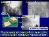 New fundamental knowledge in Paediatric Orthopaedics LECTURE / 28.02.2009