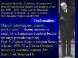New Fundamental Knowledge on Scoliosis. SCIENCE versus OPINION / LECTURE