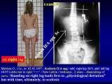 STANDING 'at free' on the right leg.Spine.Hip.Knee.Shank.LECTURE