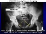 STANDING 'at free' on the right leg.Spine.Hip.Knee.Shank.LECTURE
