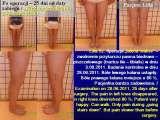STANDING 'at free' on the right leg.Spine.Hip.Knee.Shank.LECTURE