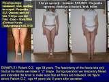 STANDING 'at free' on the right leg.Spine.Hip.Knee.Shank.LECTURE