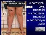 STANDING 'at free' on the right leg.Spine.Hip.Knee.Shank.LECTURE