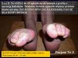 Test fleksyjny palcw stopy / Flexions test of toes LECTURE