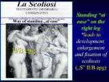 TWO LECTURES on scoliosis / Orthop.Congress in CAIRO-8.12.2006