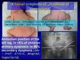 SYNDROME of CONTRACTURES-Hip Dysplasia / DDH / WryNeck/M.Blount/SCOL./LECTURES