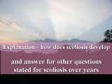 New Fundamental Knowledge on Scoliosis. SCIENCE versus OPINION / LECTURE