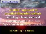 New Fundamental Knowledge on Scoliosis. SCIENCE versus OPINION / LECTURE